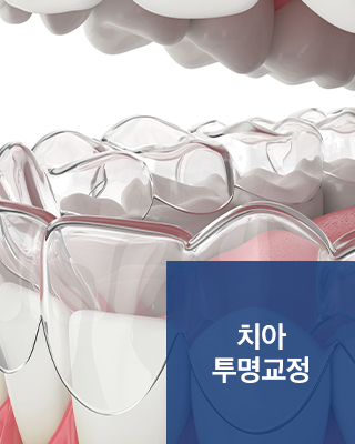 치아 투명교정