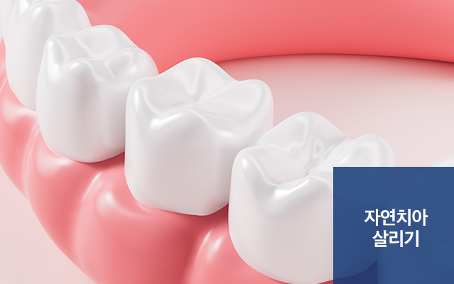 자연치아 살리기