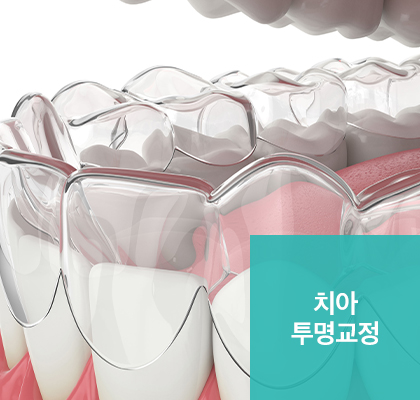 치아 투명교정