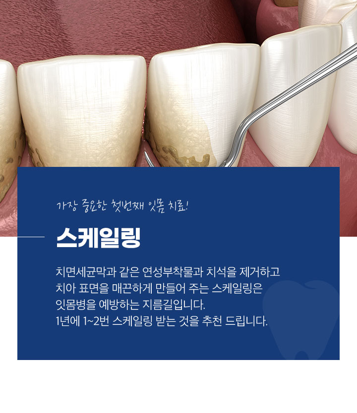 스케일링