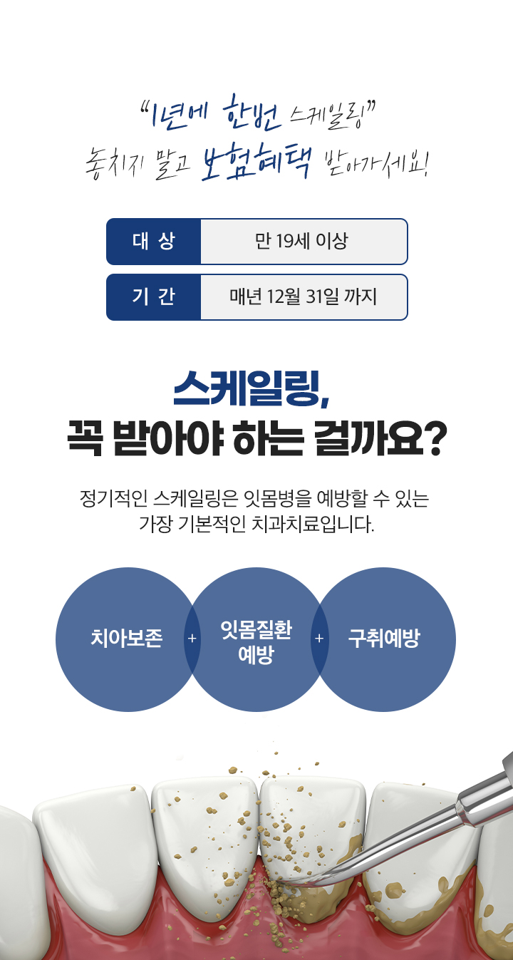 스케일링