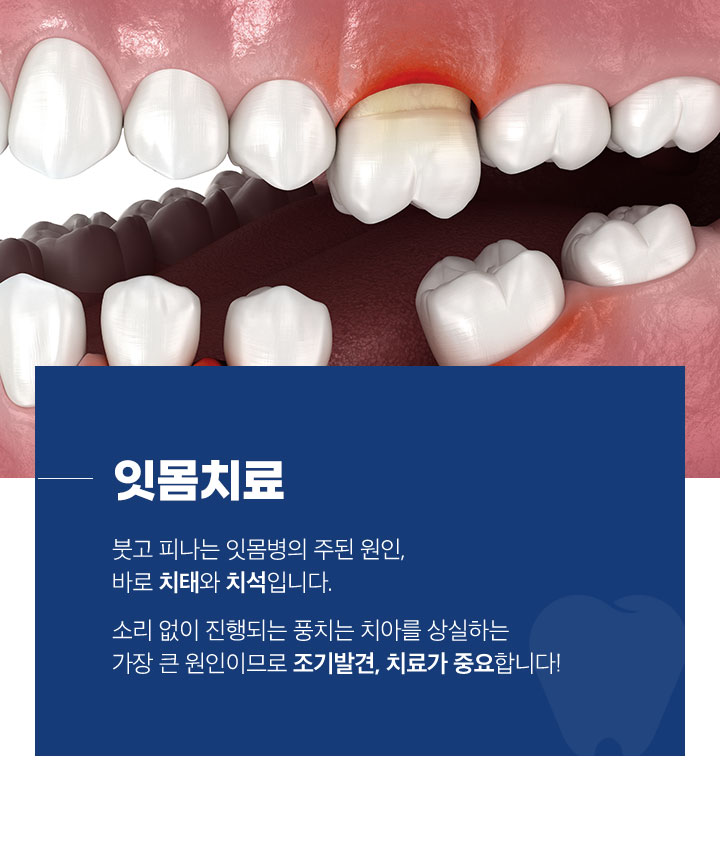 잇몸치료