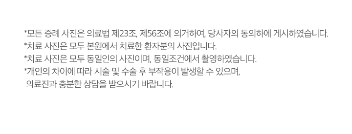 치료전후사진 업로드 주의사항