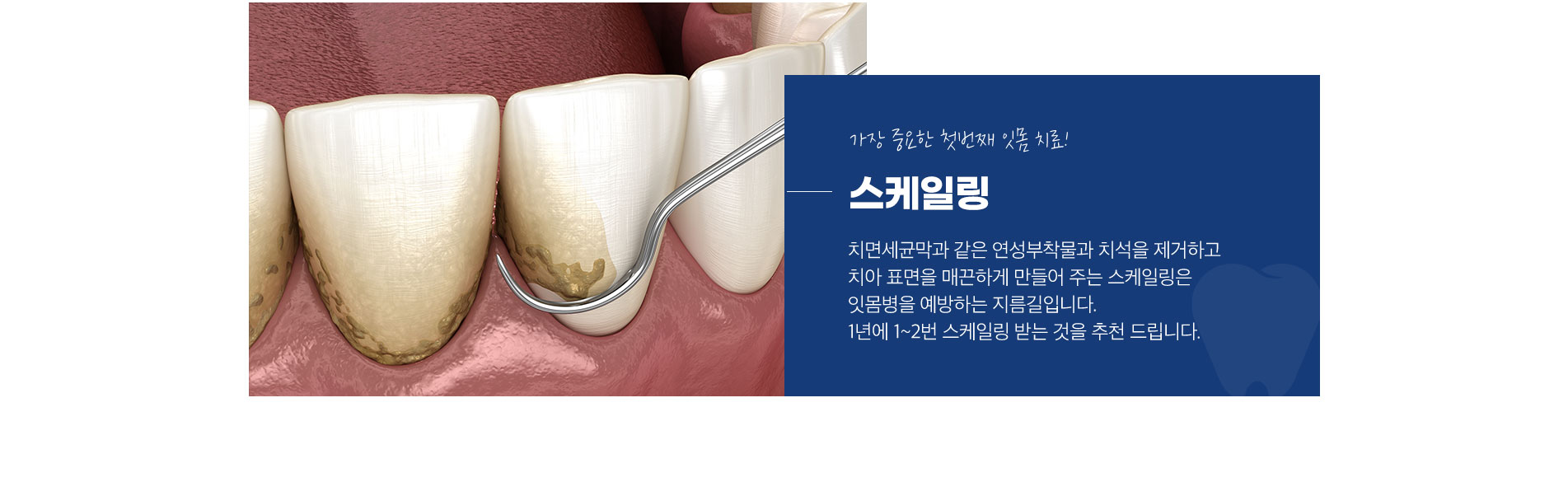스케일링