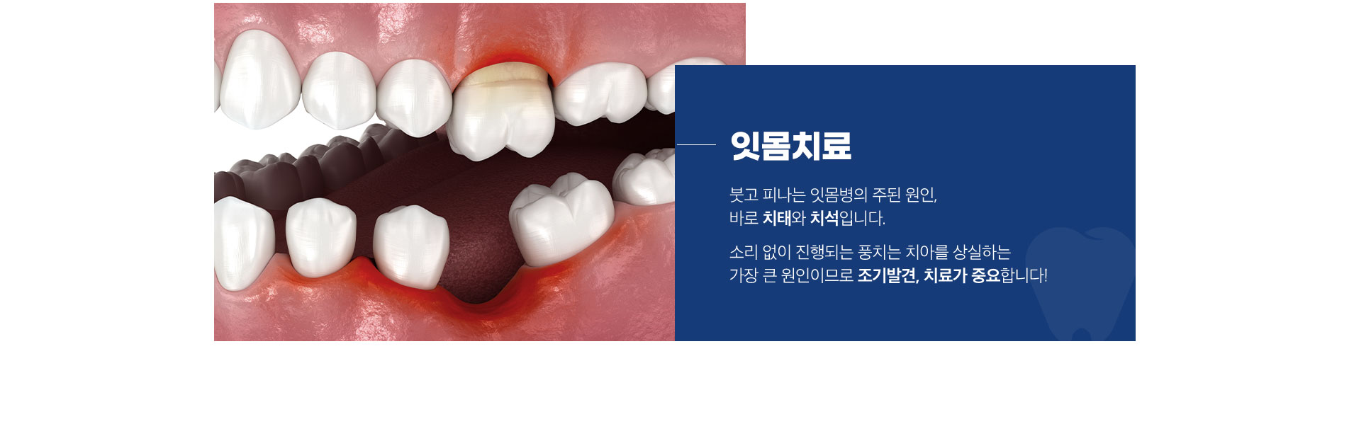 잇몸치료