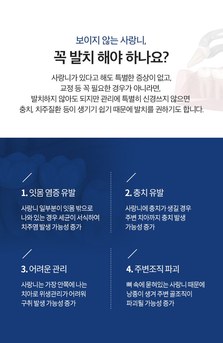 보이지 않는 사랑니, 꼭 발치 해야 하나요?