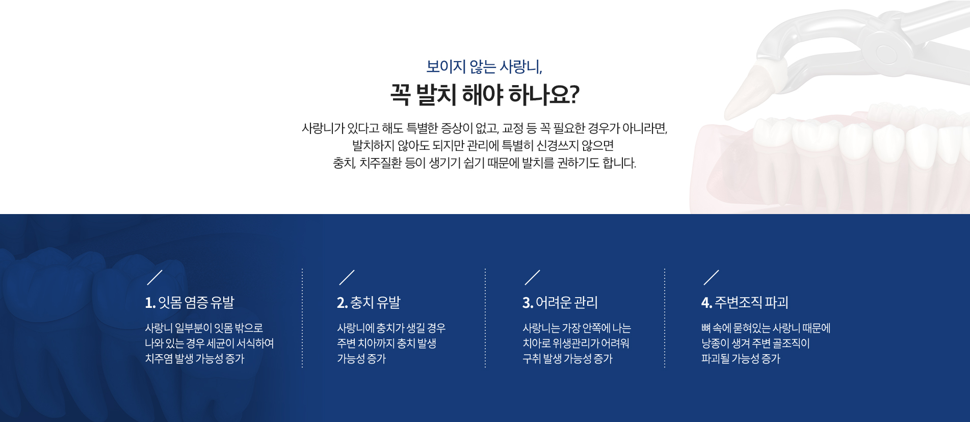 보이지 않는 사랑니, 꼭 발치 해야 하나요?