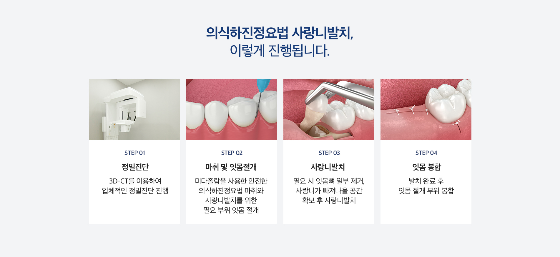 의식하진정요법 사랑니발치, 이렇게 진행됩니다.