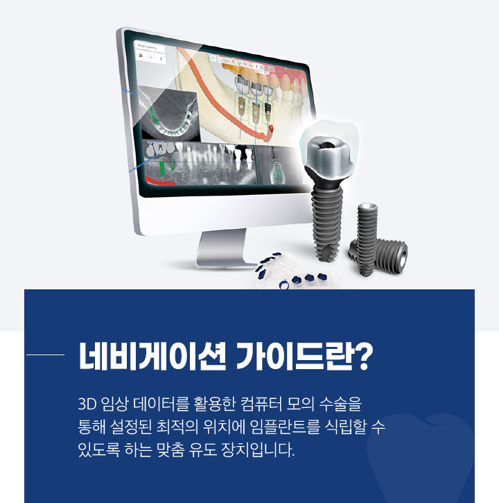 네비게이션 가이드란?