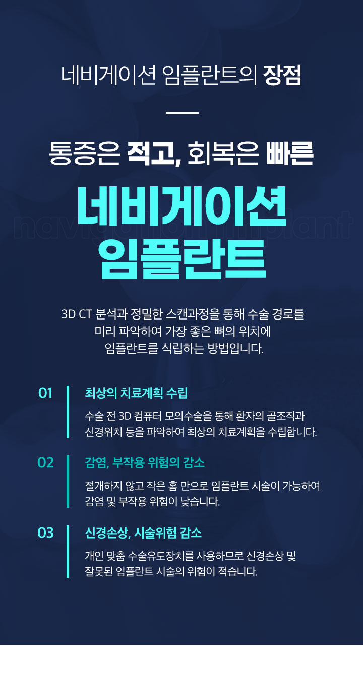 네비게이션 임플란트의장점