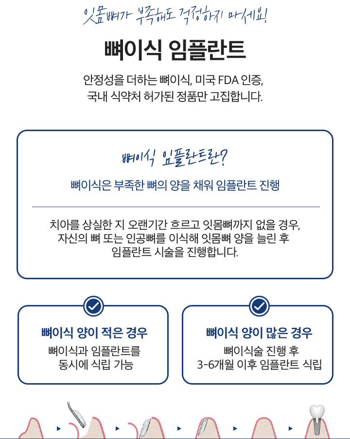 잇몸뼈가 부족해도 걱정하지 마세요!