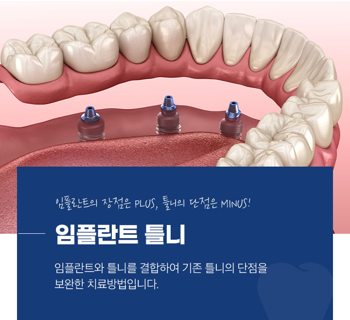 임플란트 건강보험 대상자