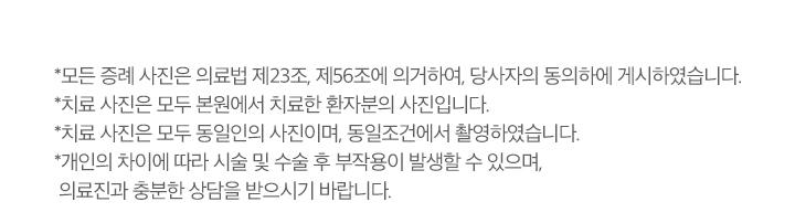 치료전후사진 업로드 주의사항