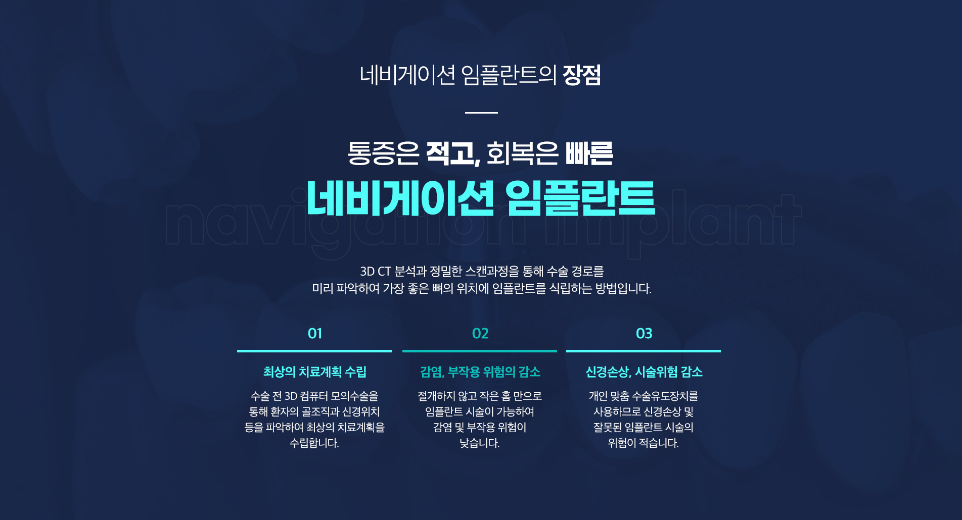 네비게이션 임플란트의장점