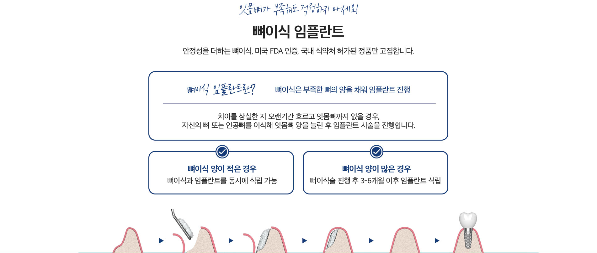 잇몸뼈가 부족해도 걱정하지 마세요!