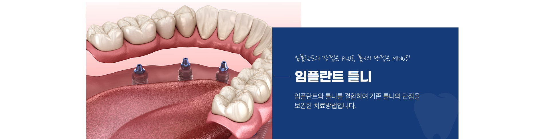 임플란트 건강보험 대상자