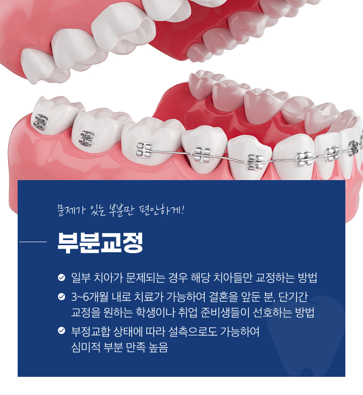 부분교정