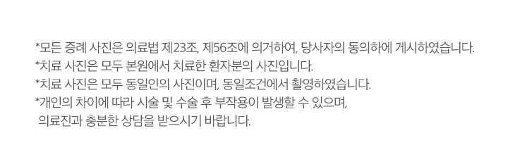 치료전후사진 업로드 주의사항