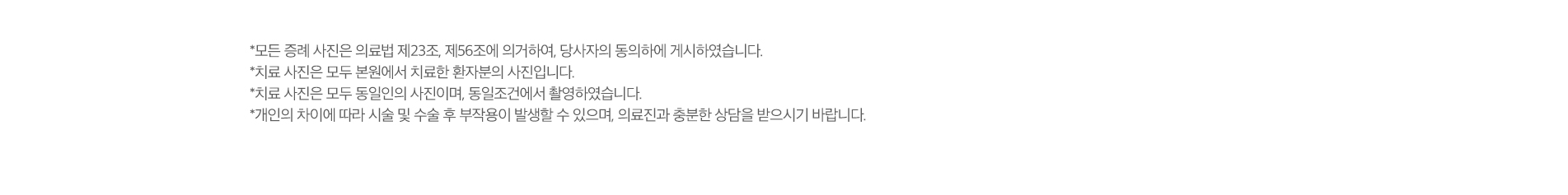 치료전후사진 업로드 주의사항