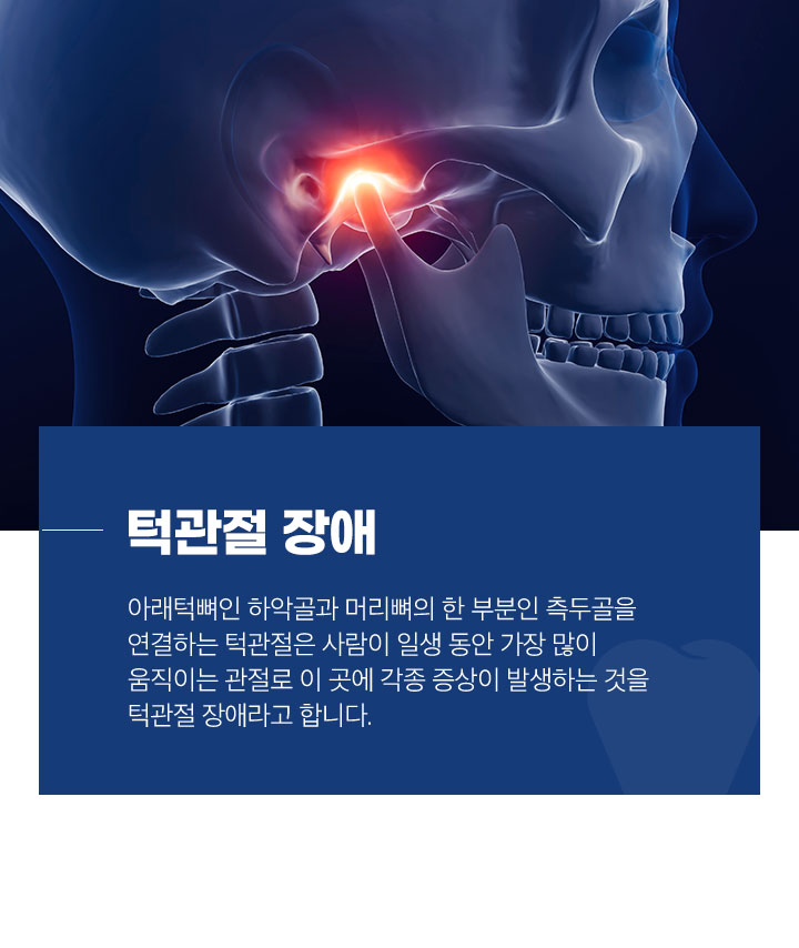 턱관절 장애