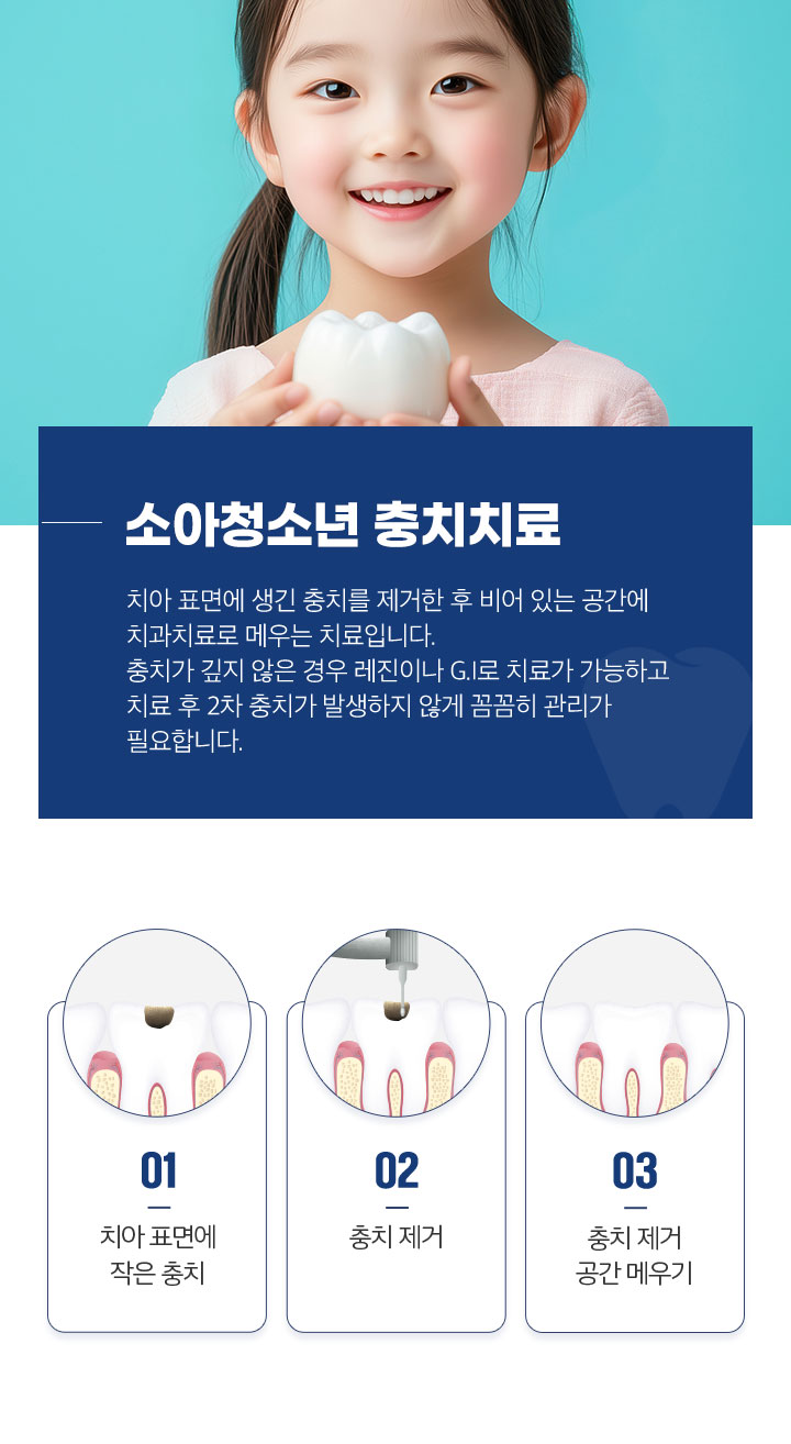 소아청소년 충치치료