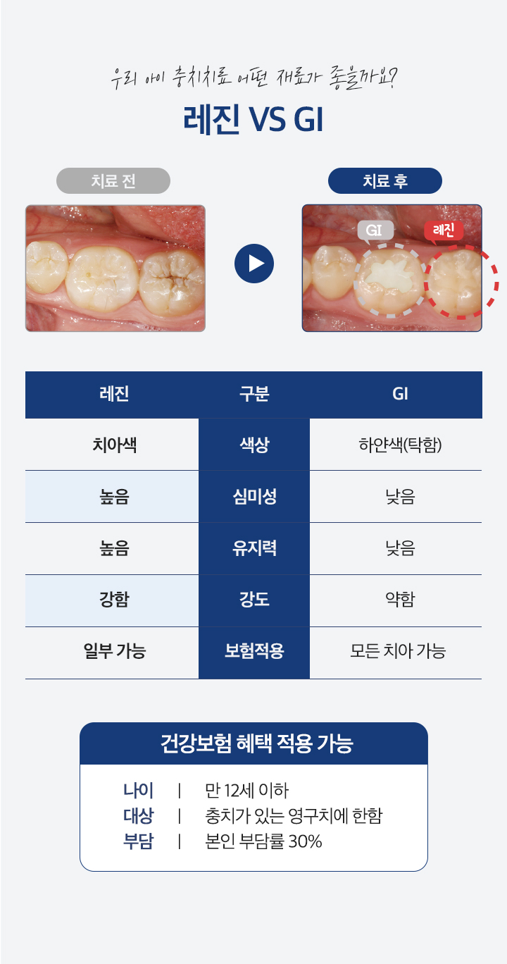 우리 아이 충치치료 어떤 재료가 좋을까요? 레진 vs GI