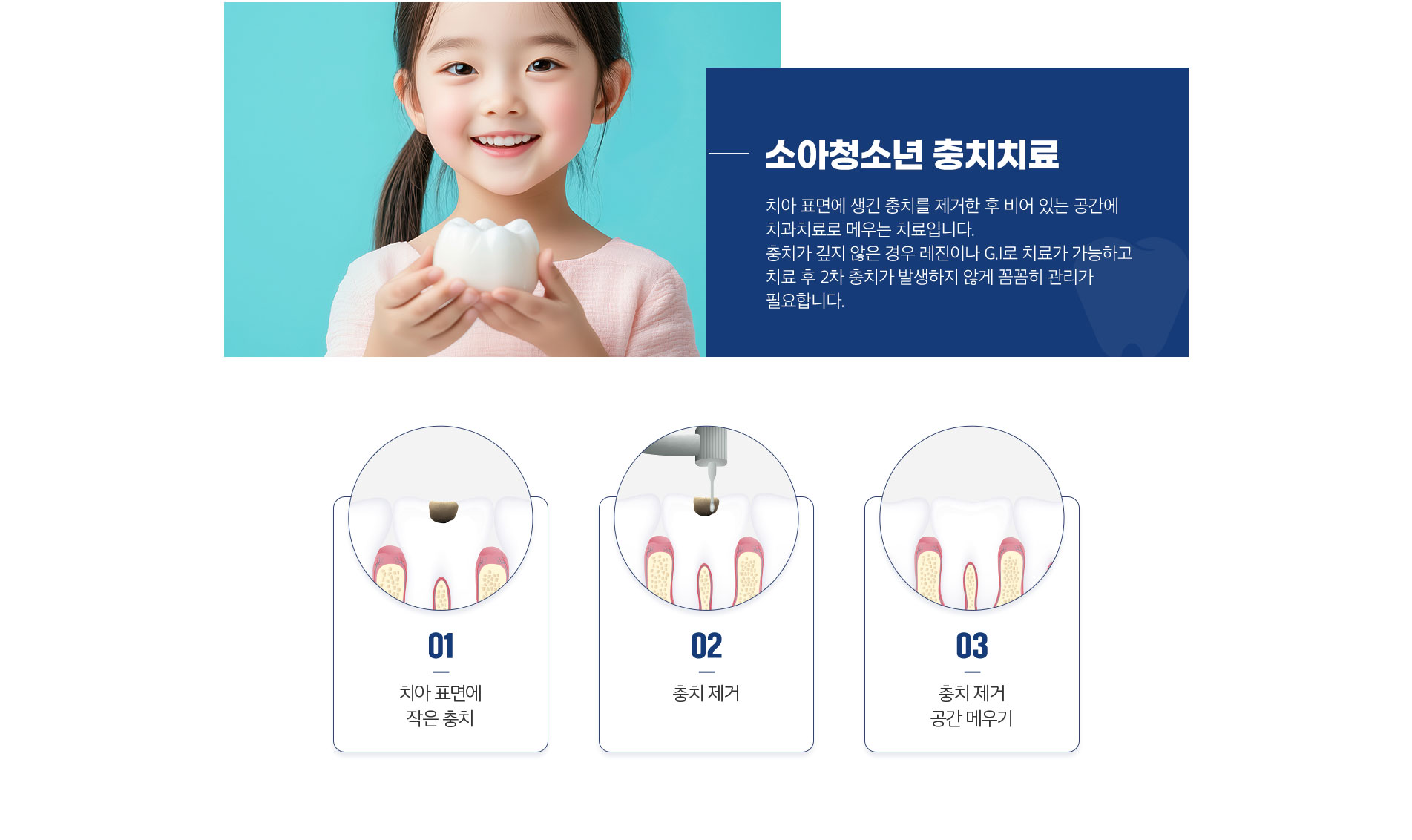 소아청소년 충치치료