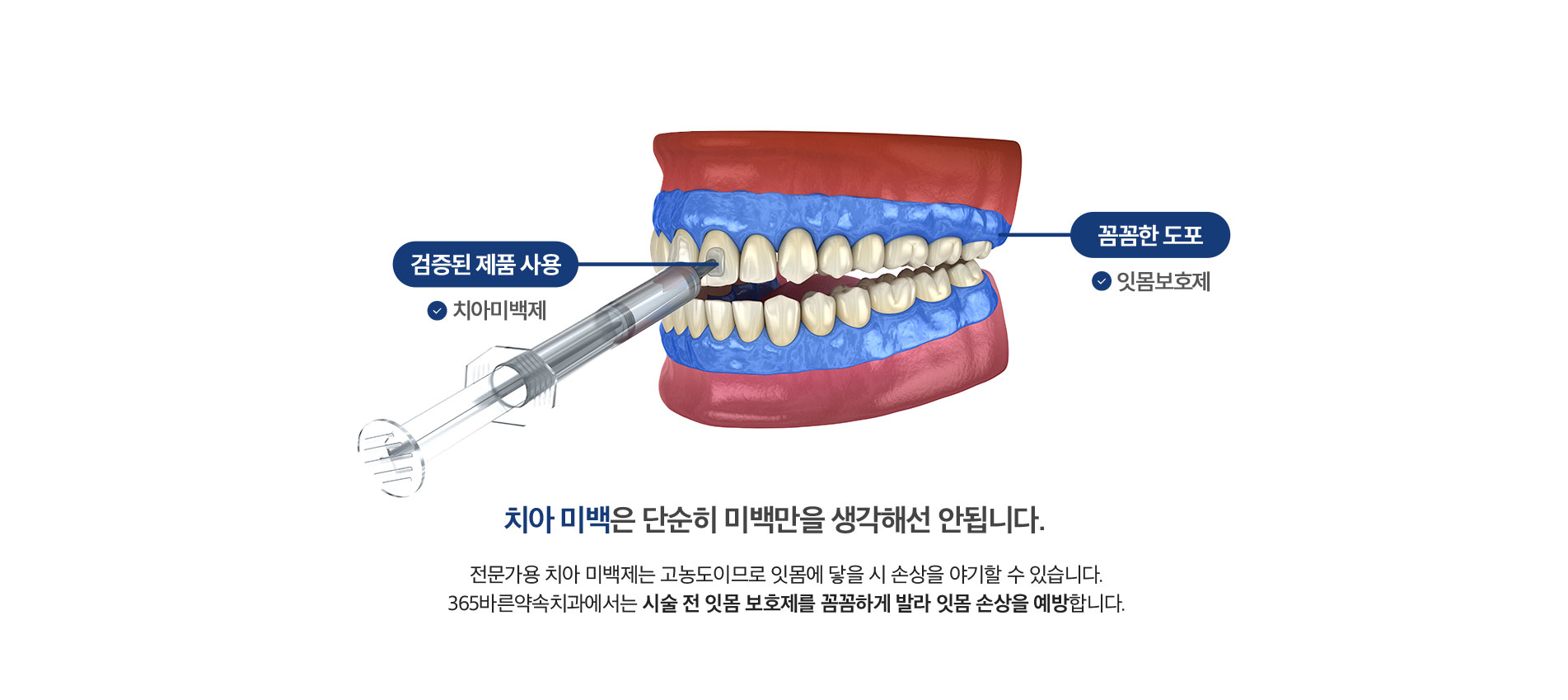 치아 미백은 단순히미백만을 생각해선 안됩니다.