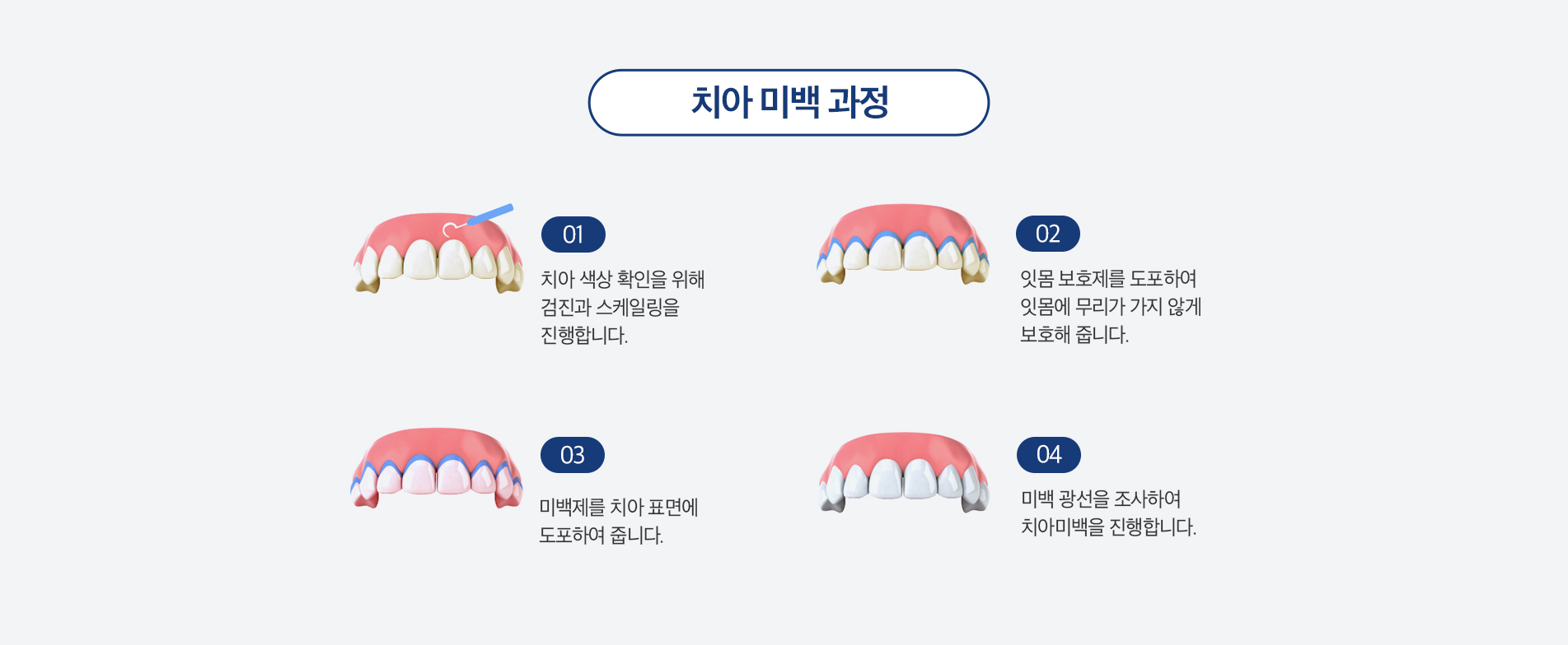 치아 미백 과정